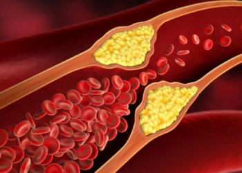 Chế độ ăn phòng tăng mỡ máu ở người cao tuổi